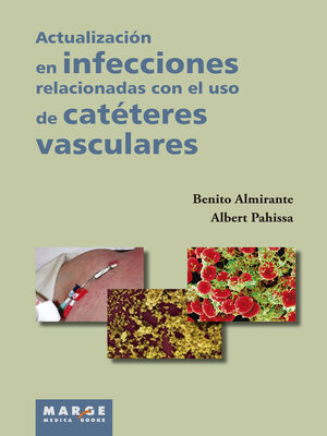 cover image of Actualización en infecciones relacionadas con el uso de catéteres vasculares